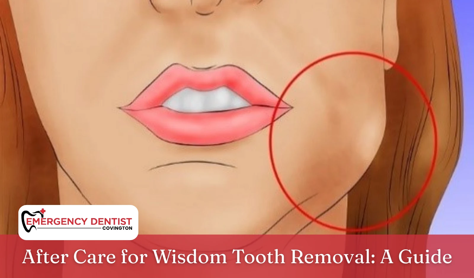 After Care for Wisdom Tooth Removal A Guide