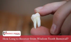 How Long to Recover from Wisdom Tooth Removal
