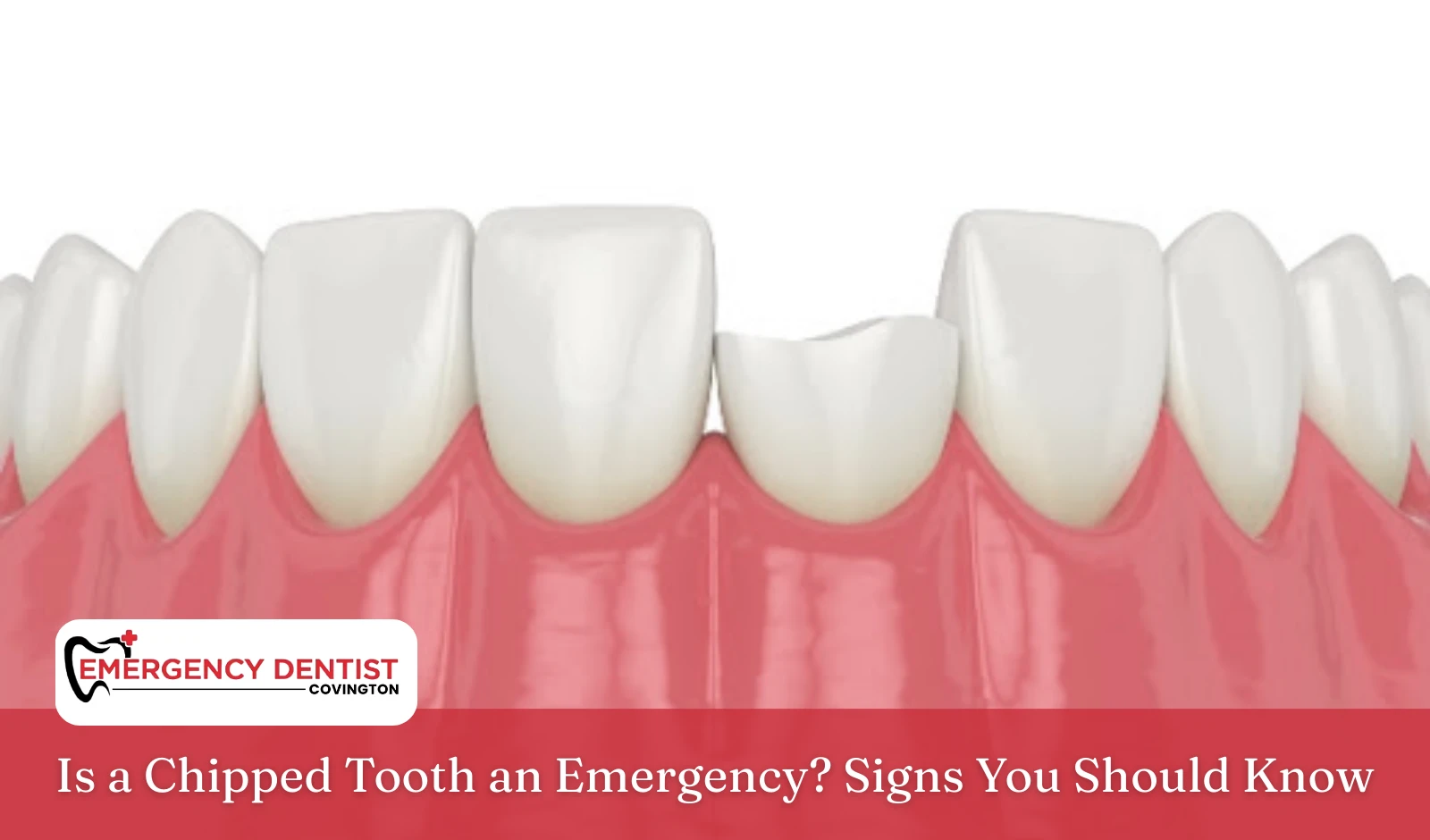 Is a Chipped Tooth an Emergency Signs You Should Know