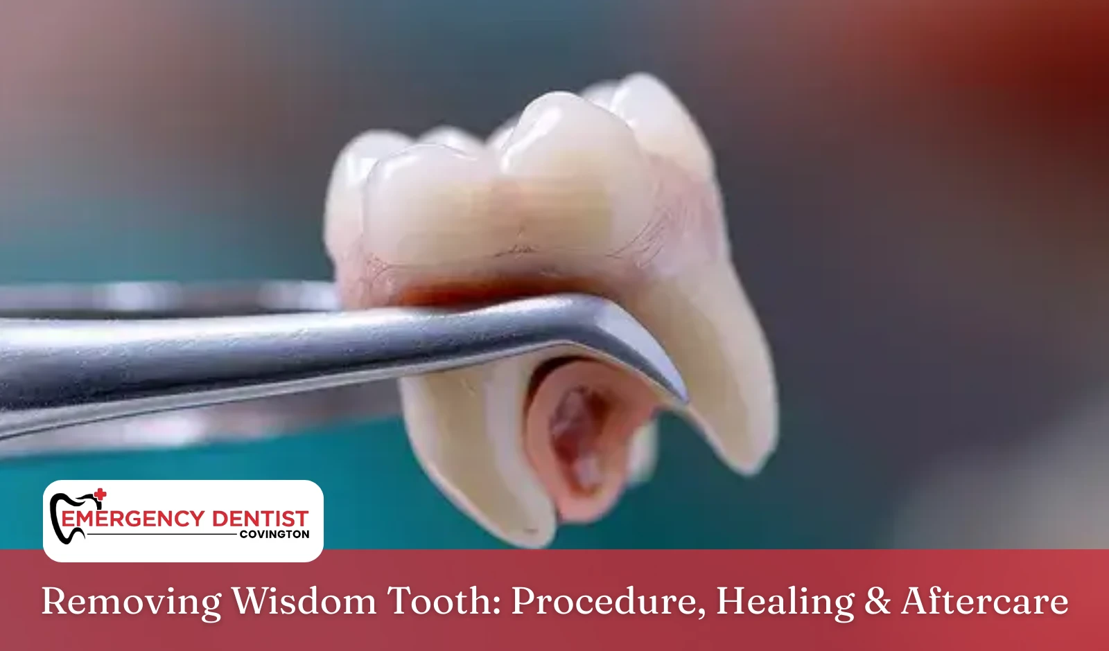 Removing Wisdom Tooth Procedure, Healing & Aftercare