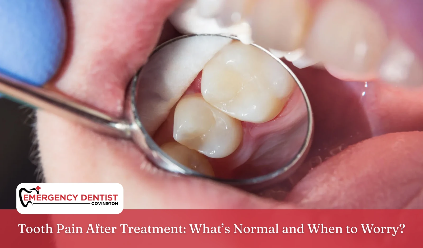 Tooth Pain After Treatment What’s Normal and When to Worry