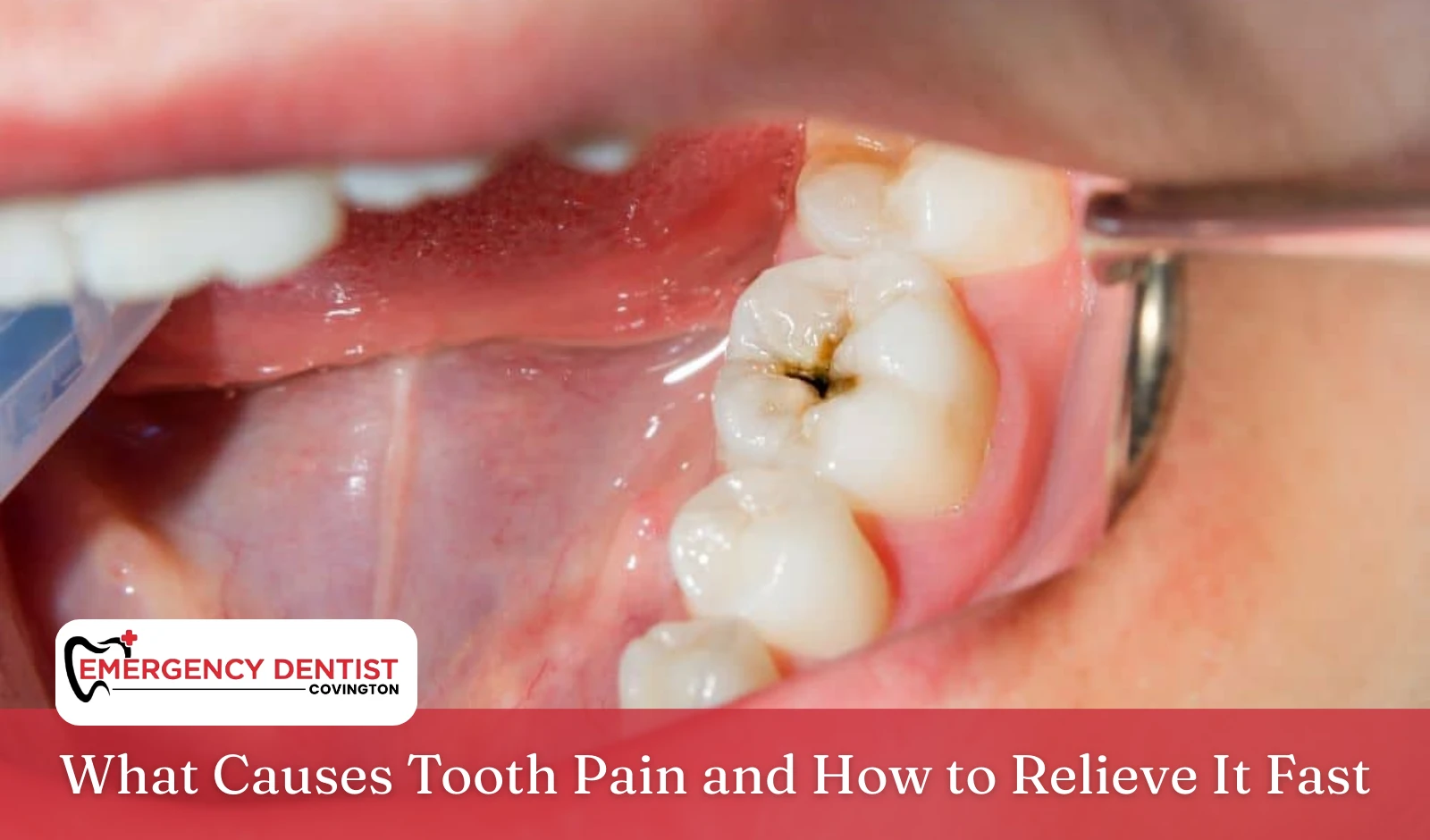 What Causes Tooth Pain and How to Relieve It Fast