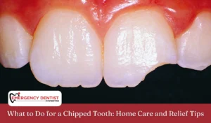 What to Do for a Chipped Tooth Home Care and Relief Tips