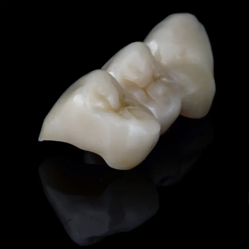 Broken-or-cracked-dental-bridge-Covington-GA