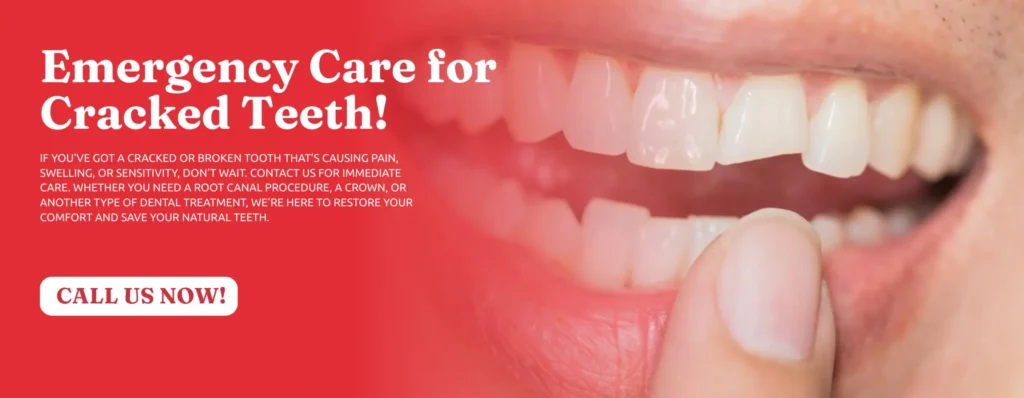 Cracked-Tooth-Repair-in-Covington-GA