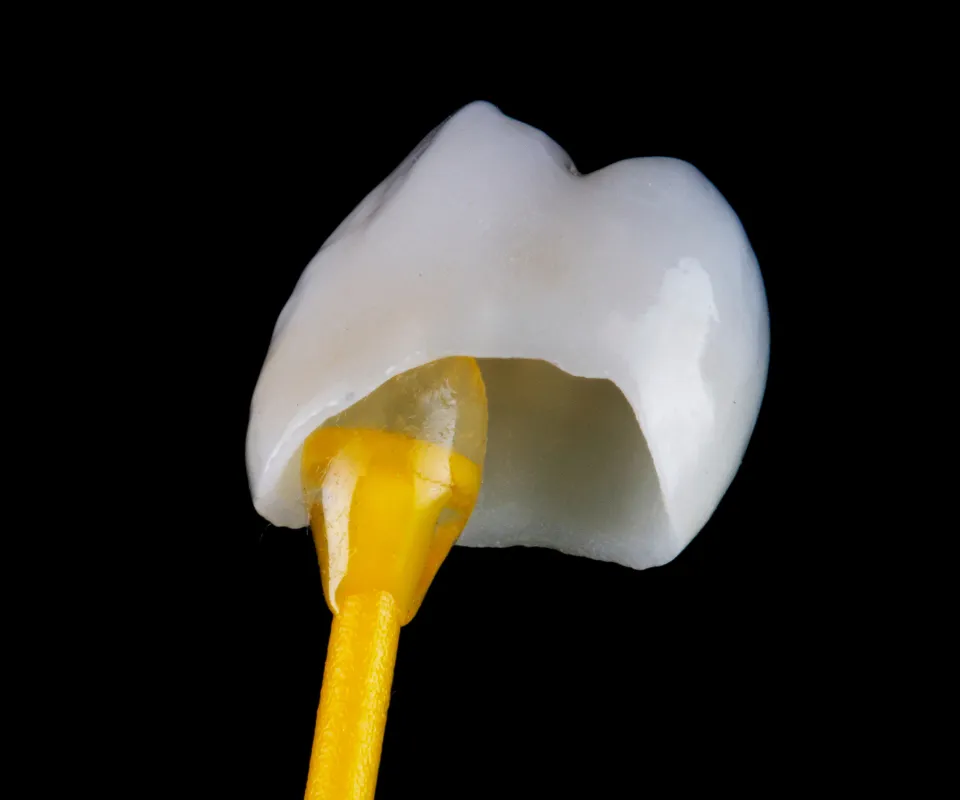 Dental-Crowns-Covington-GA
