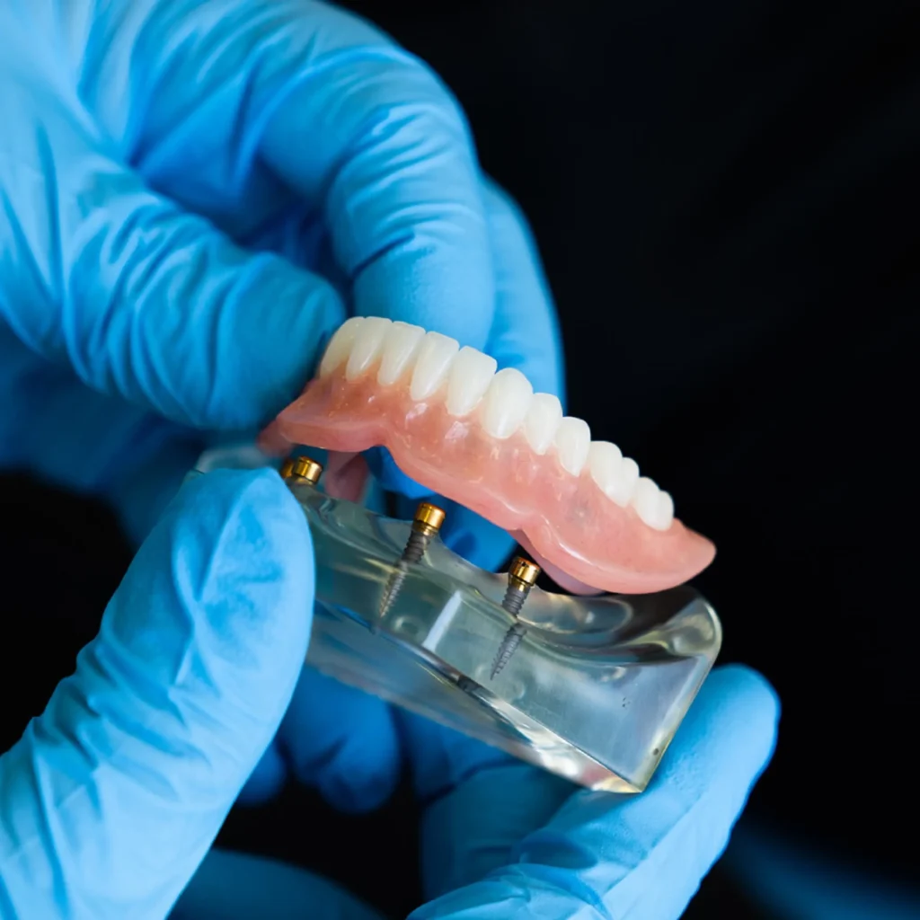 Emergency-Denture-Repairs-Covington-GA