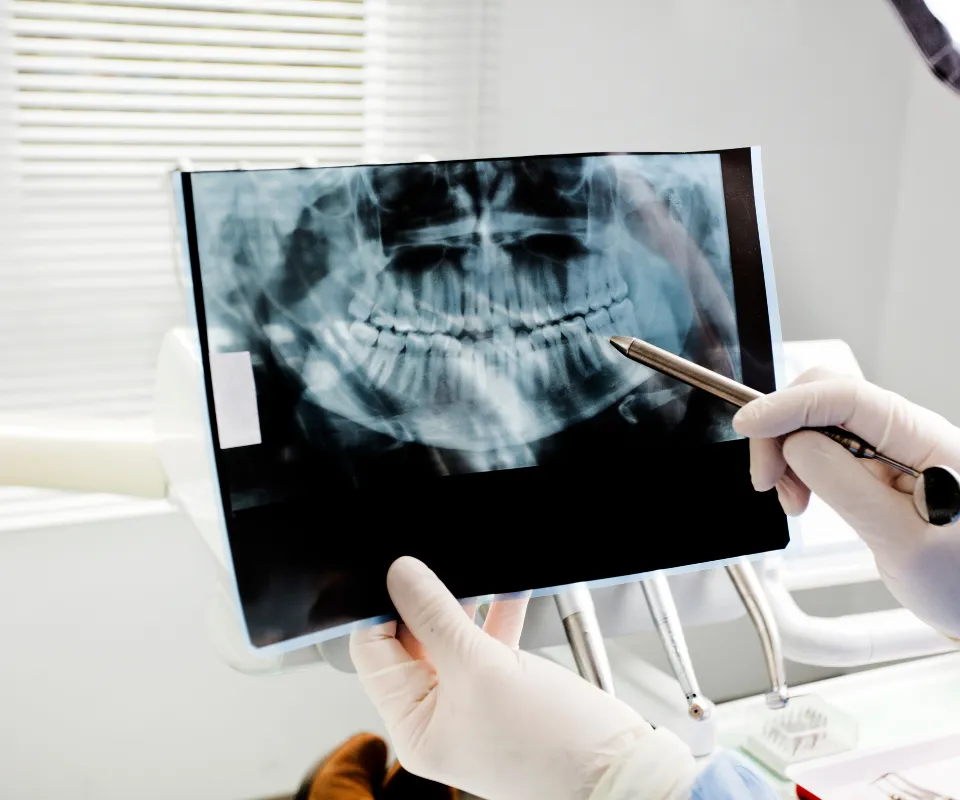 Emergency-dental-X-rays-Covington-GA