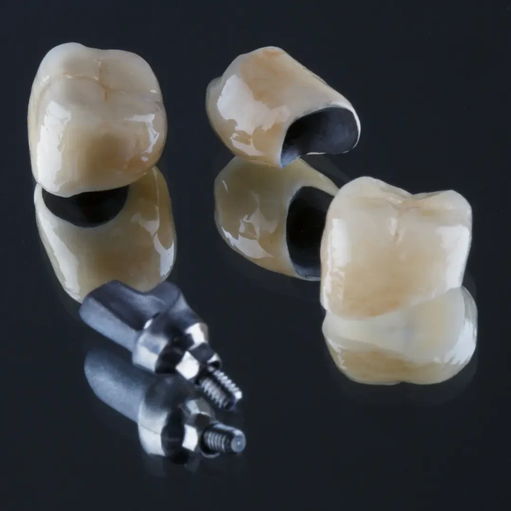 Loose-dental-bridge-or-crown-Covington-GA