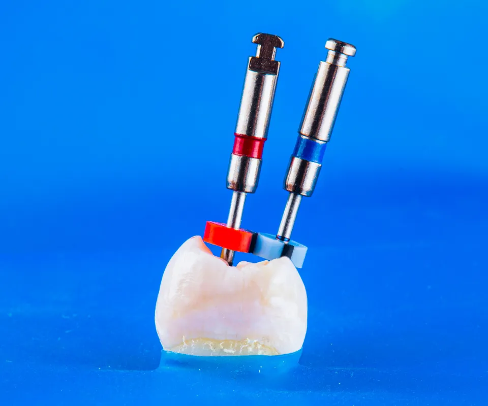Root-Canal-Treatment-Covington-GA