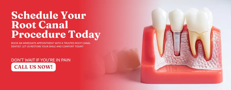Schedule-Root-Canal-Procedure-in-Covington-GA