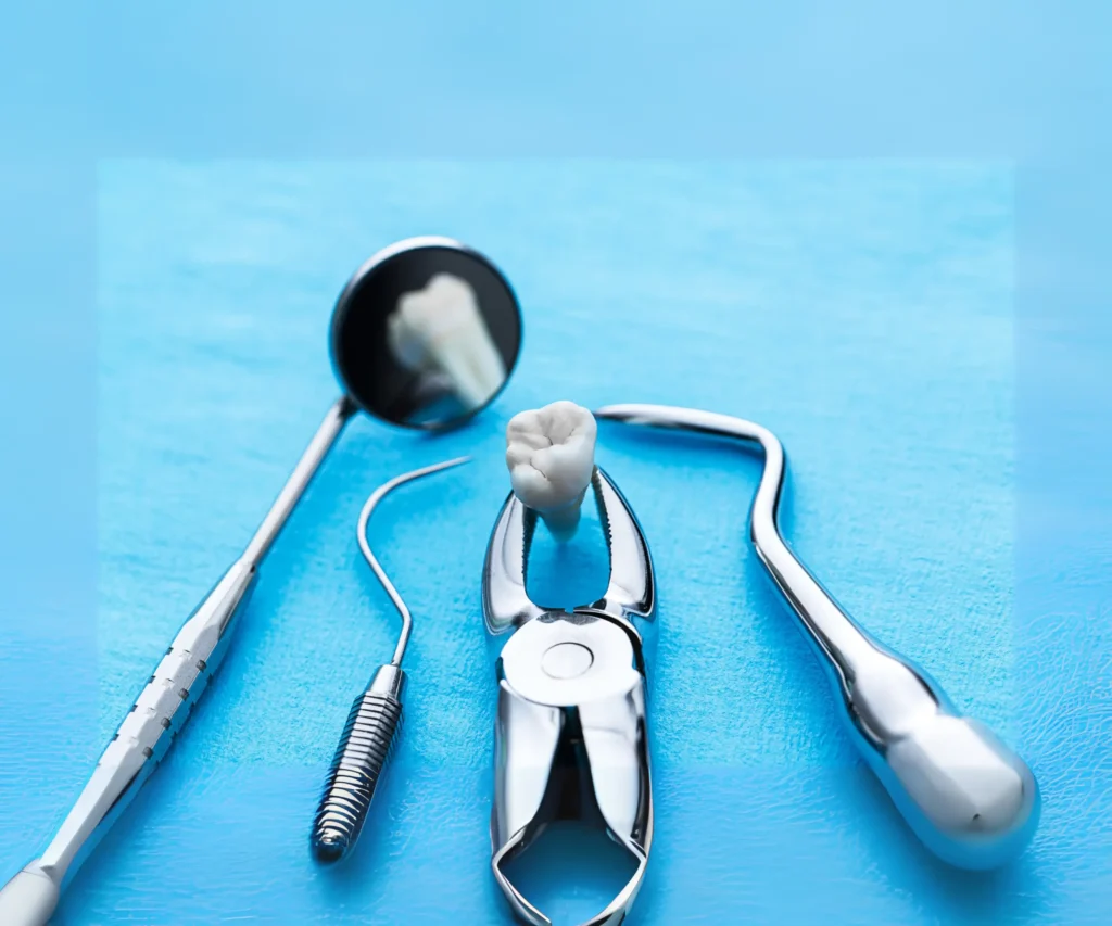Simple-Tooth-Extractions-Covington-GA