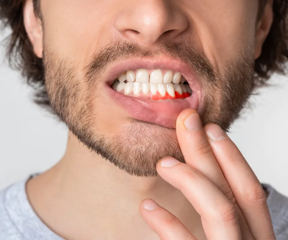 When-to-See-an-Emergency-Dentist-for-a-Tooth-Infection-Covington-GA