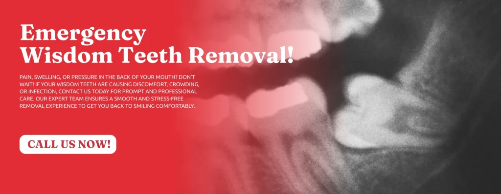 Book-Wisdom-Teeth-Removal-Covington-GA