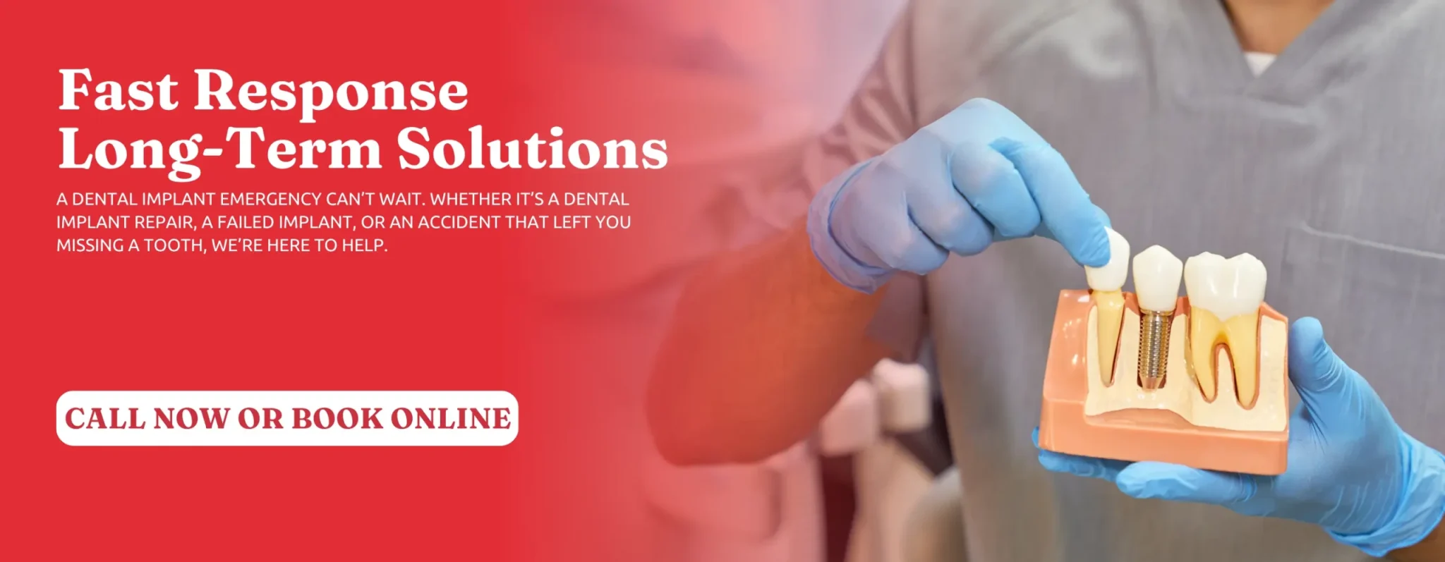 Dental-Implant-Emergency-in-Covington-GA