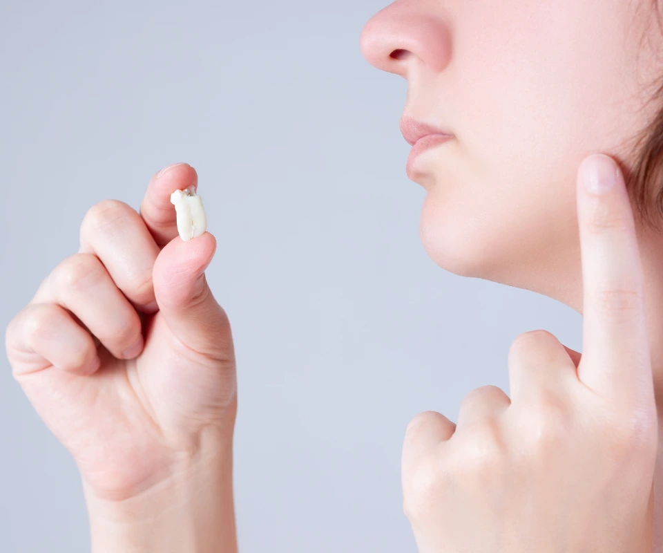 Emergency-Wisdom-Tooth-Extraction-in-Covington-GA