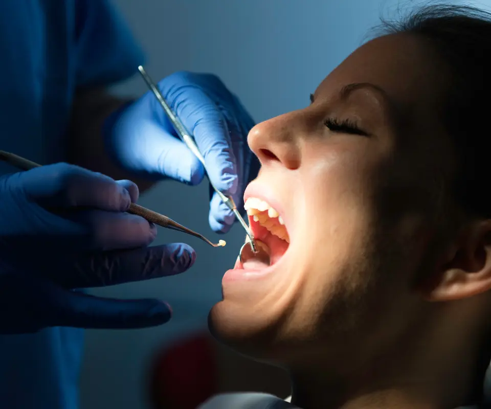 Lost-Fillings-or-Crowns-Covington-GA