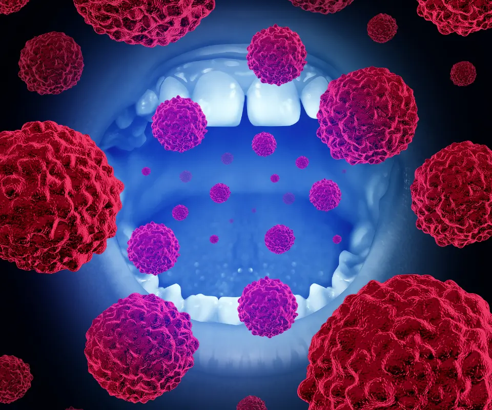 Oral-Cancer-Covington-GA